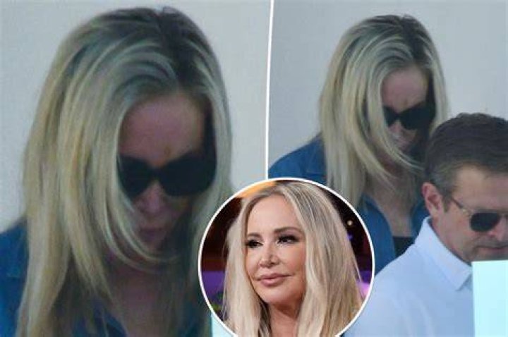 Shannon Beador’s Face Injured in DUI Crash, Possible Need for Plastic Surgery